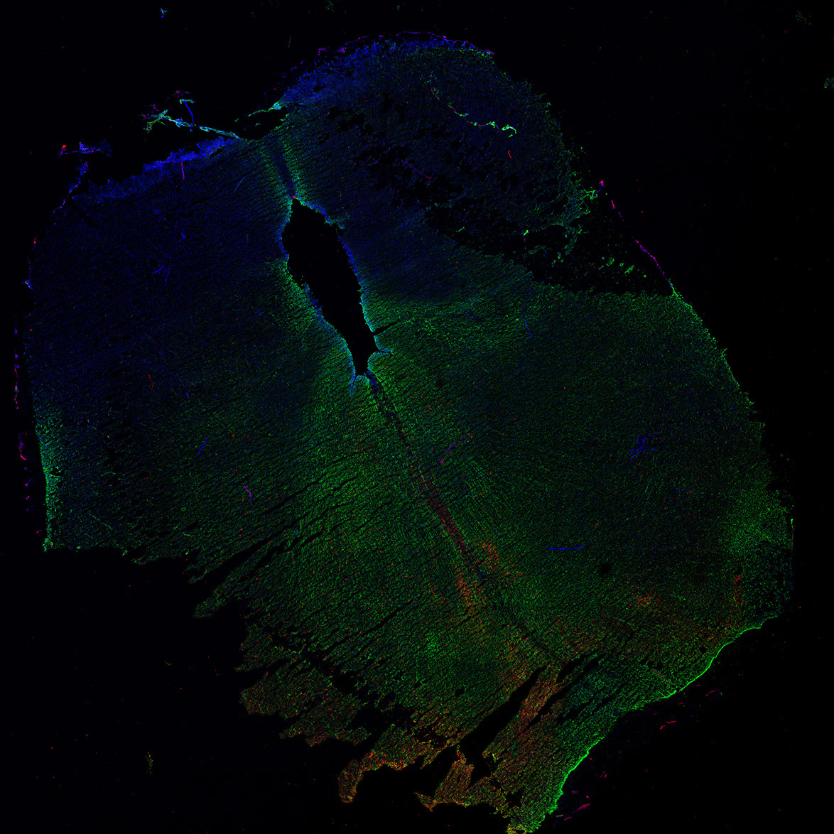 Human foetal midbrain